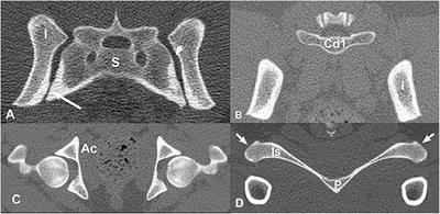 Computed Tomographic Evaluation of the Sacroiliac Joints of Young Working Labrador Retrievers of Various Work Status Groups: Detected Lesions Vary Among the Different Groups and Finite Element Analyses of the Static Pelvis Yields Repeatable Measures of Sacroiliac Ligament Joint Strain